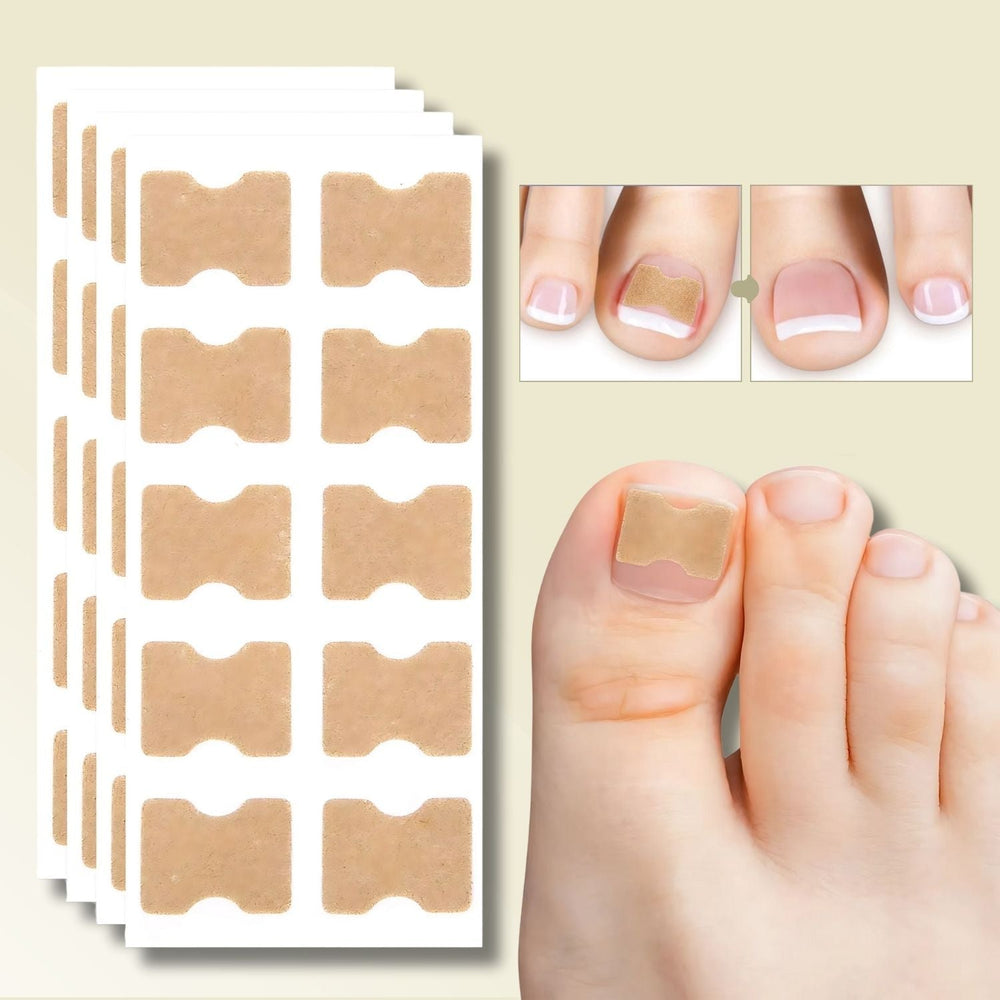 Fungi Nail Patches for Instant Relief from Ingrown Nails and Nail Fungus – 10 Count
