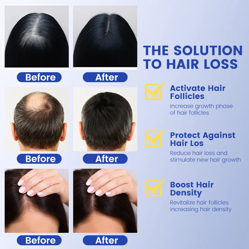Copper Peptide Hair Growth Serum for Hair Loss & Thinning Hair Feline Skinscience Copper Peptide Hair Growth Serum for Hair Loss & Thinning Hair Feline Skinscience