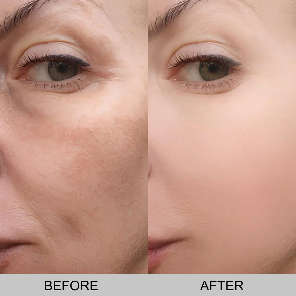 Peel Shot Rice Ampoule Duo | 1+1 FREE