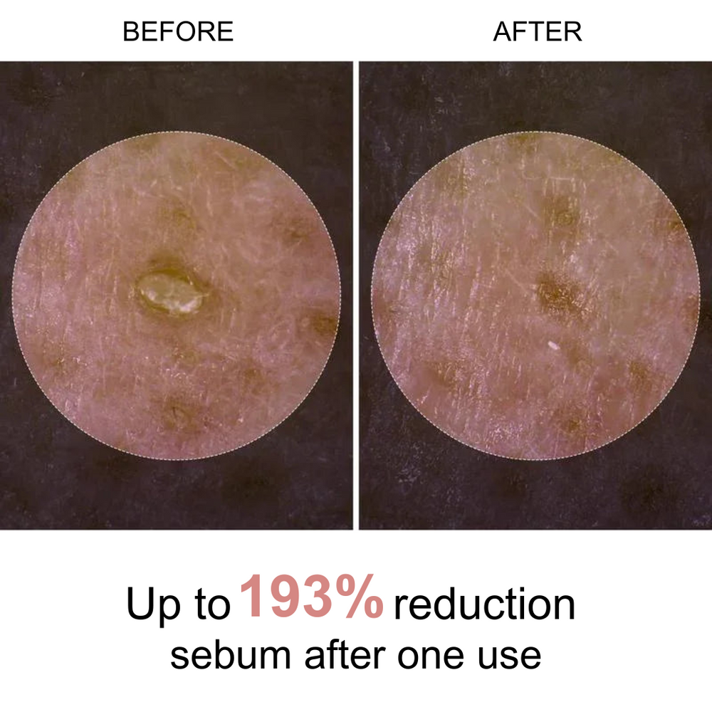 Peel Shot Rice Ampoule Duo | 1+1 FREE