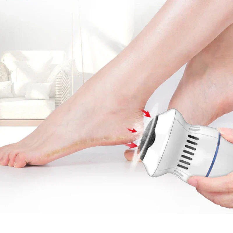 PediGlow | Effective Ergonomic Electric Callus Remover for Smooth Feet