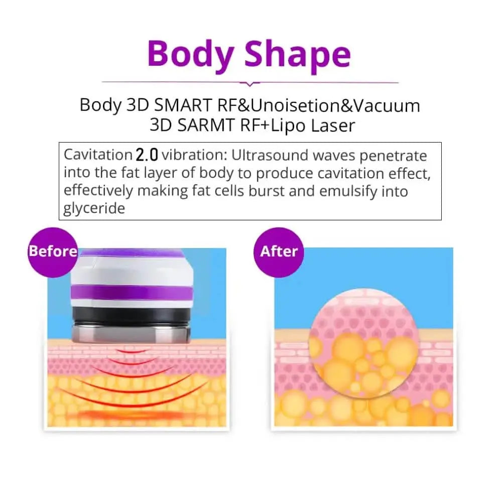 Cavitation Machine 40K 6 in 1 Ultrasonic - Upgrade