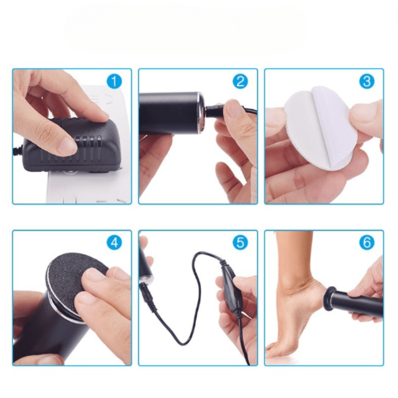 SmoothFeet | Electric Pedicure Device for Gentle Callus and Foot Care