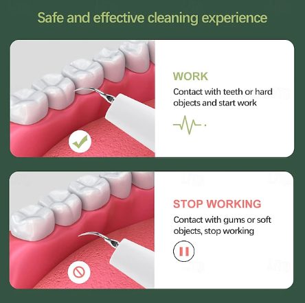 Dentora | Professional Ultrasonic Tartar Remover for Easy At-Home Cleaning
