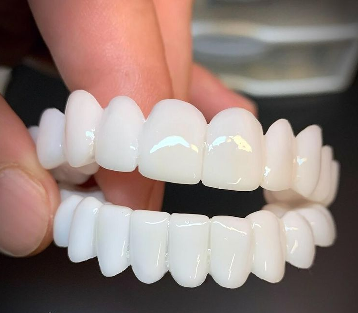 DentAlign | Professional Dental Prosthetics for Natural Smile Restoration
