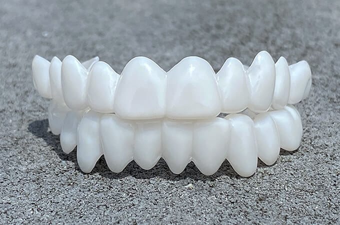 DentAlign | Professional Dental Prosthetics for Natural Smile Restoration