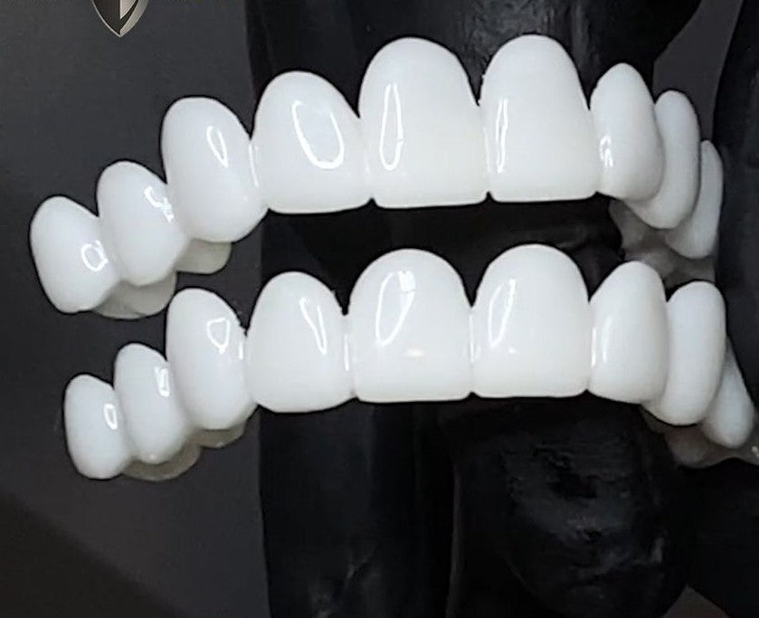 DentAlign | Professional Dental Prosthetics for Natural Smile Restoration