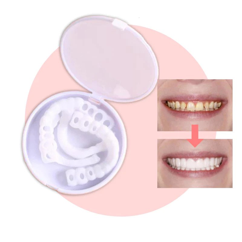 SmileSnap | Perfect Veneer Snap-On Teeth for a Confident Smile