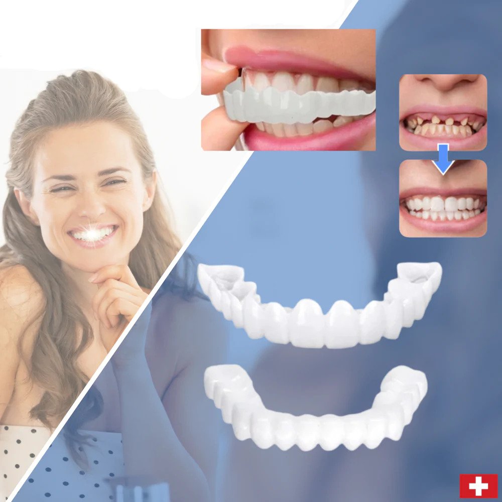 SmileSnap | Perfect Veneer Snap-On Teeth for a Confident Smile