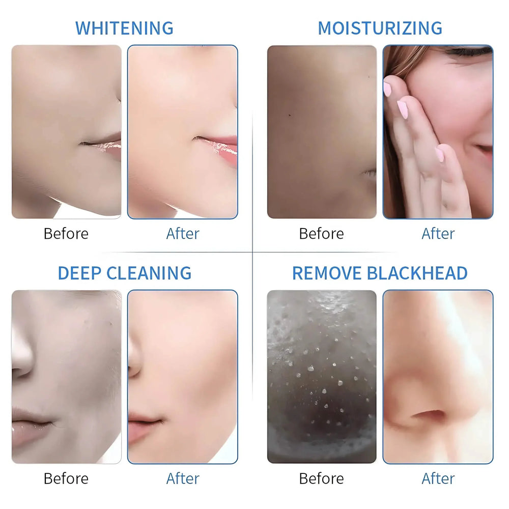 6 In 1 Hydra Dermabrasion Machine Pro Gen 1