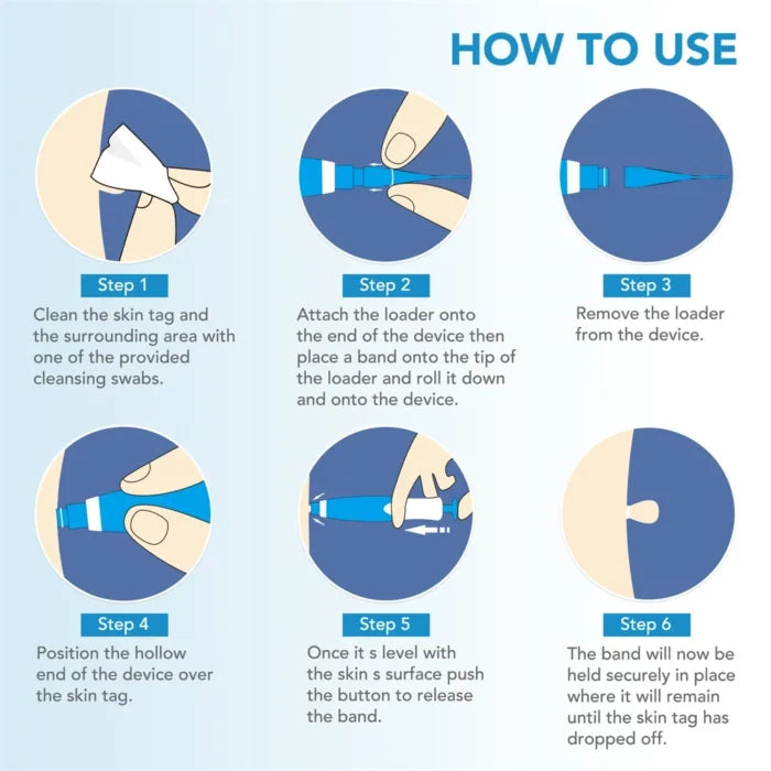 Skin Tag & Mole Remover Kit for Painless Treatment at Home