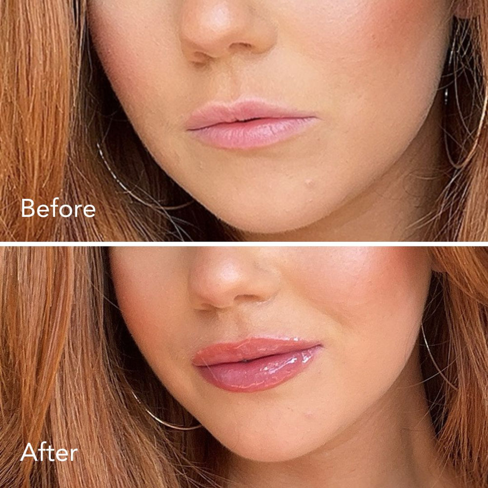 Lip Plumper + Hydrator