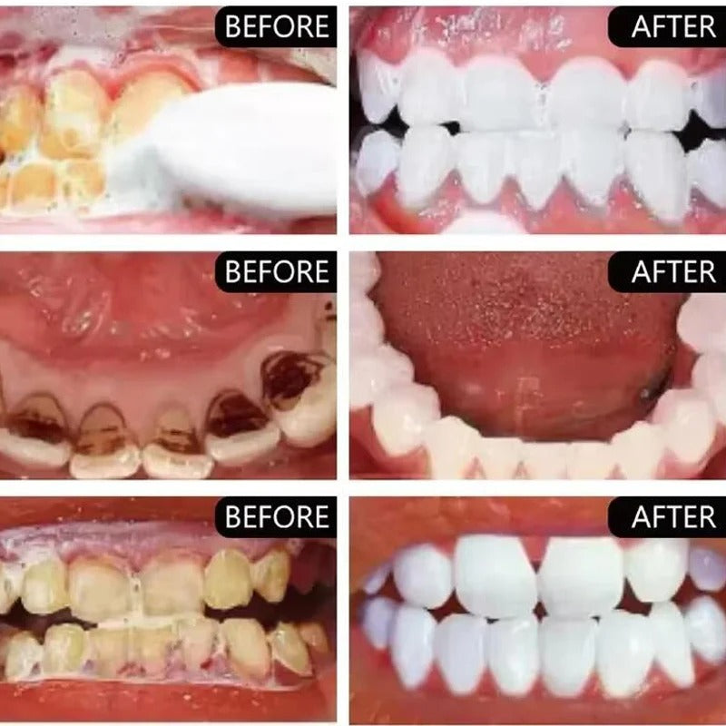 Instant Teeth Whitening Powder
