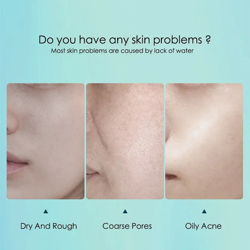 10pcs Hyaluronic Acid Facial Mask – Hydrating & Pore Refining Skincare