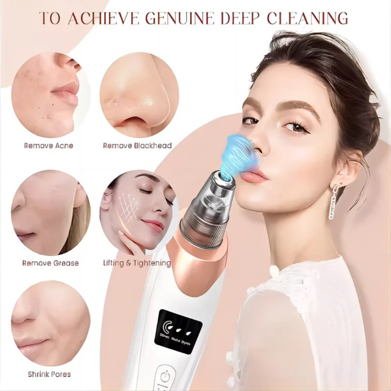 Blackhead Remover Vacuum Pore Cleaner – Electric Acne Extractor Tool