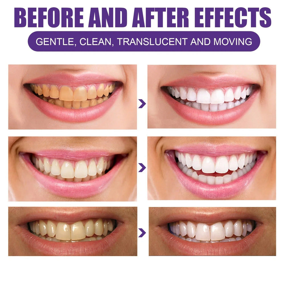 Purple Teeth Whitening Powder – Stain Removal [30gr]