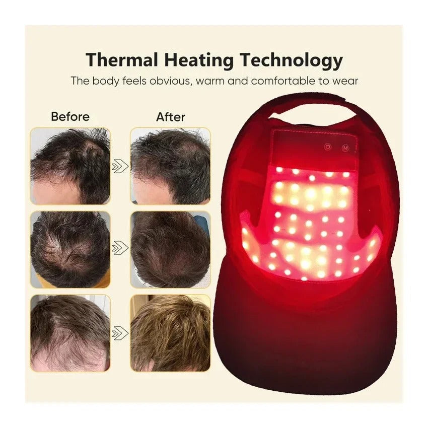 Red & Infrared Light Therapy Hair Growth Cap