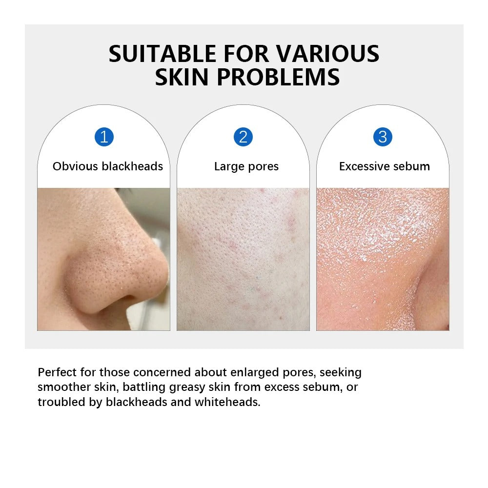 Zero Pore Pad 2.0 – Exfoliating & Pore-Smoothing Korean Facial Toner Pads (70pcs)