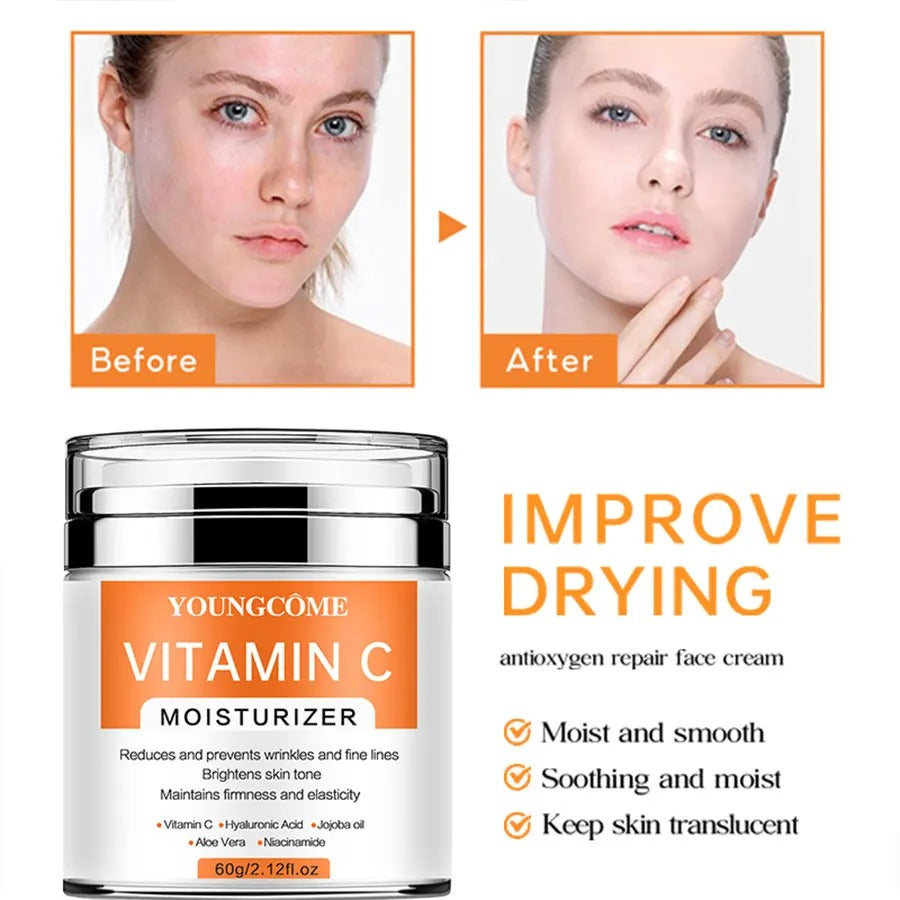 Vitamin C Face Cream – Whitening, Anti-Aging & Dark Spot Remover