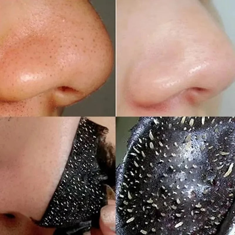 Bamboo Charcoal Blackhead Remover Mask – Pore Cleansing & Acne Care
