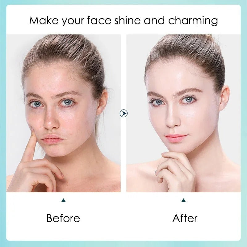 10pcs Hyaluronic Acid Facial Mask – Hydrating & Pore Refining Skincare