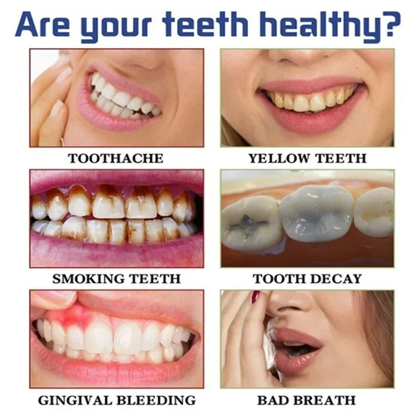 Instant Teeth Whitening Toothpaste