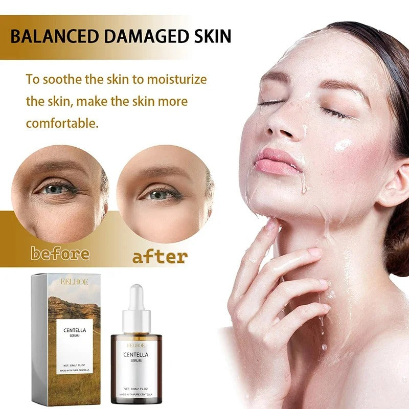 Centella Asiatica Face Serum – Hydrating, Brightening & Skin Repair [30mL]