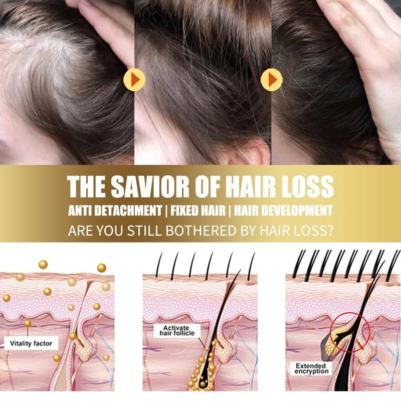 Anti-Dandruff Exfoliating Scalp Scrub – Anti-Itch & Oil Control Treatment