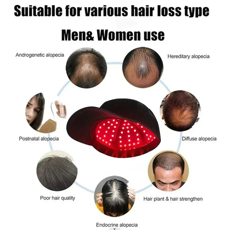 660nm & 850nm Red Light Therapy Hair Growth Cap