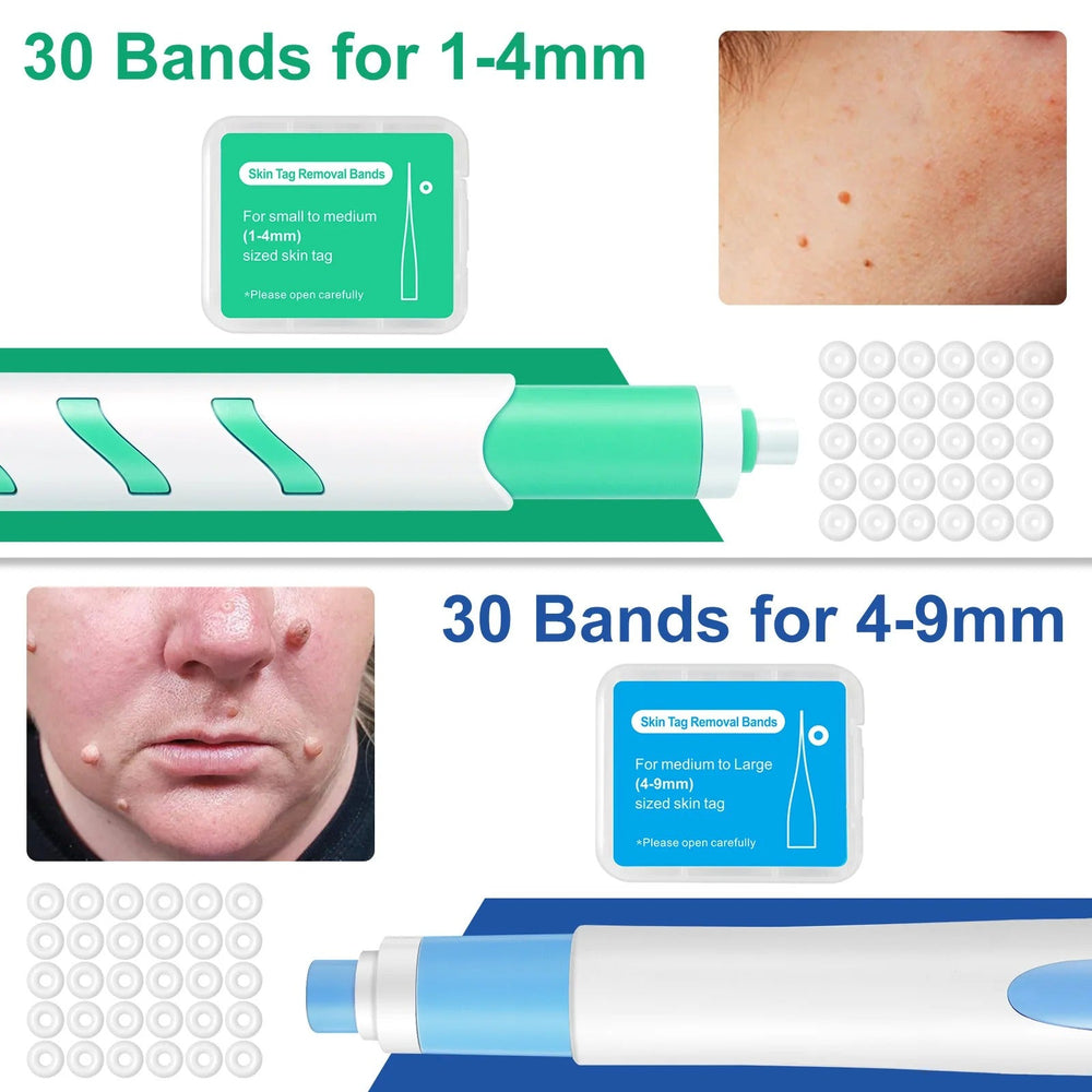 2-in-1 Skin Tag & Mole Removal Pen Kit with Cleansing Swabs