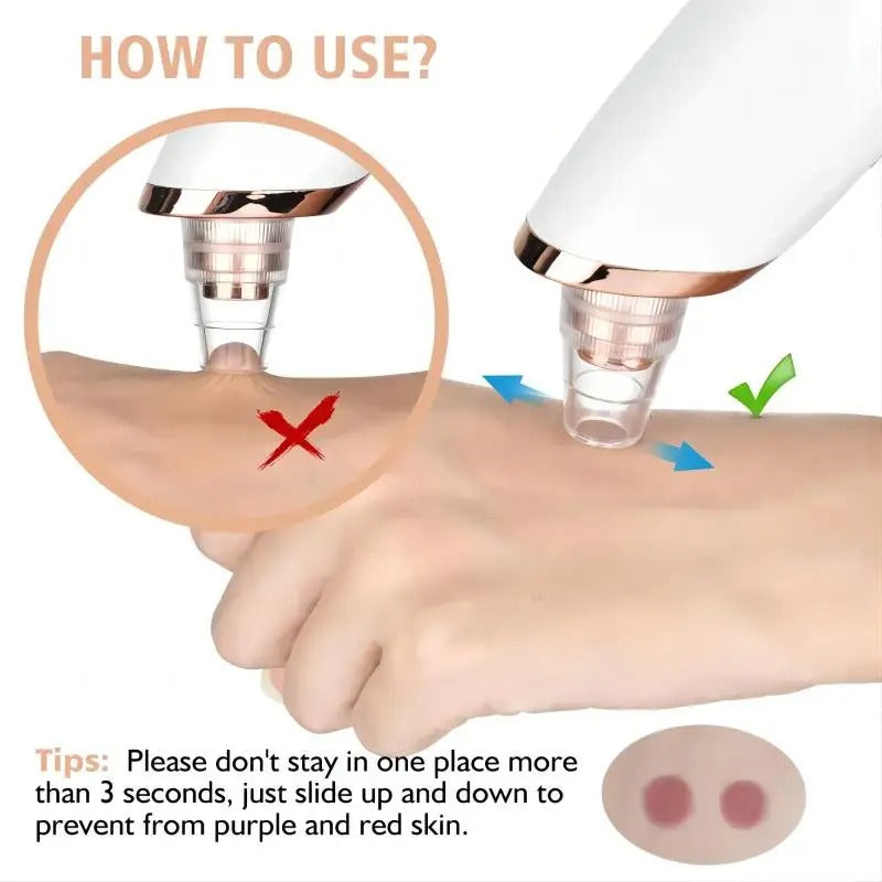 Blackhead Remover Vacuum Pore Cleaner – Electric Acne Extractor Tool