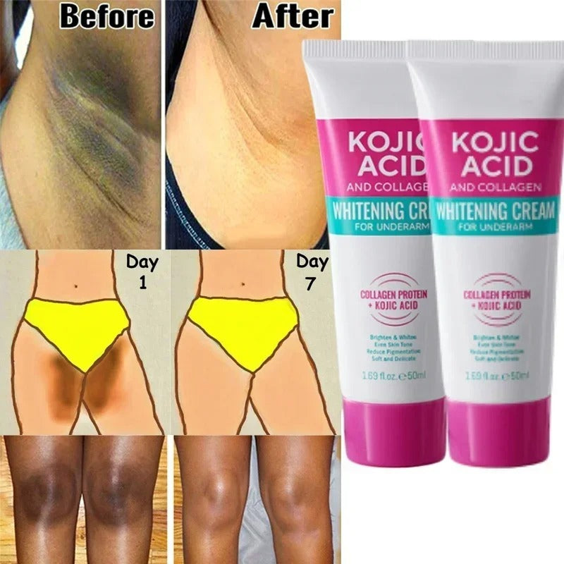 Collagen Underarm Whitening Cream with Kojic Acid and Moisturizer