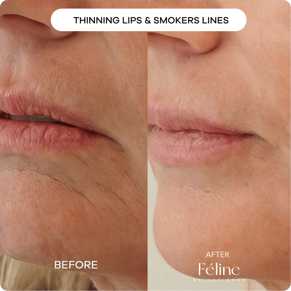 Age-Defying Lift & Firm Cream | 1+1 FREE