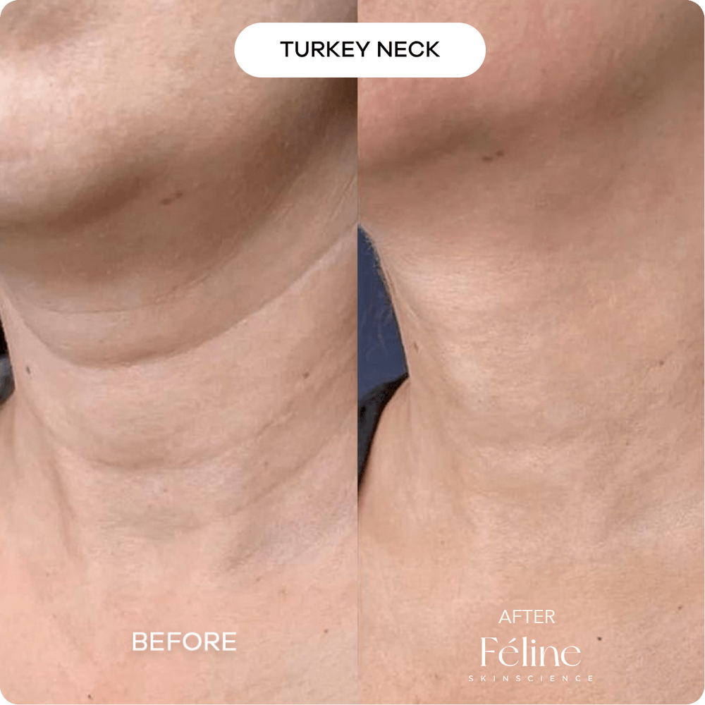 Advanced Crepe Fix | 1+1 FREE