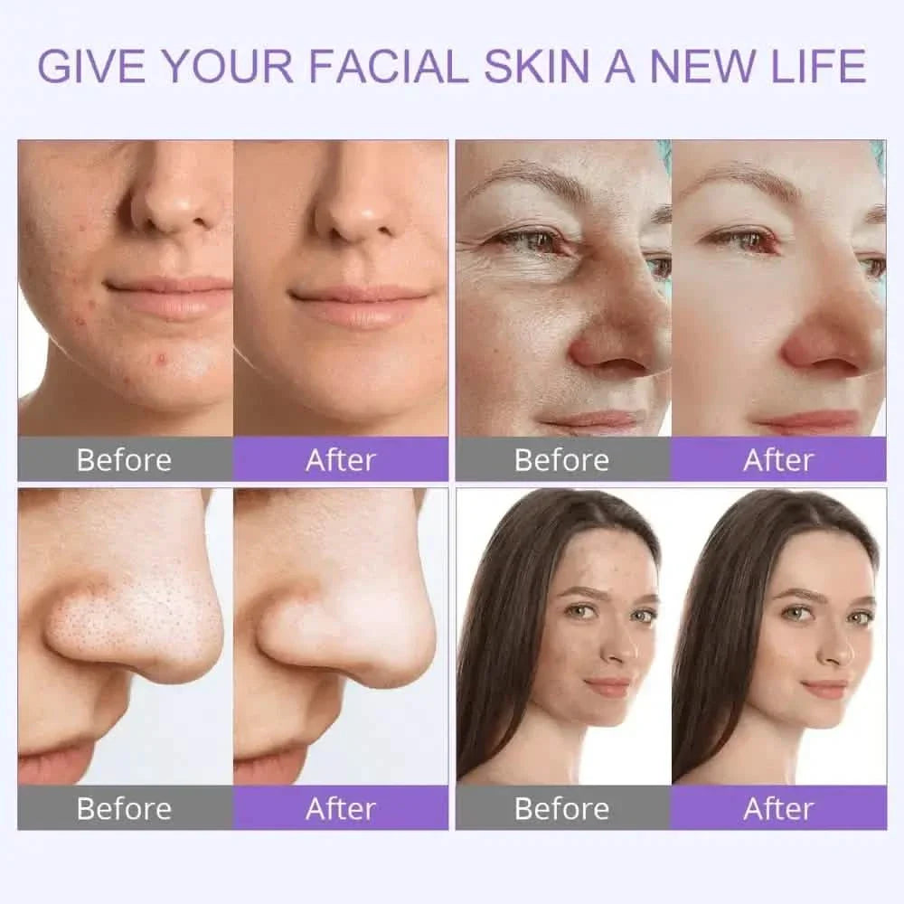 6 In 1 Hydro Dermabrasion Facial Machine Purple
